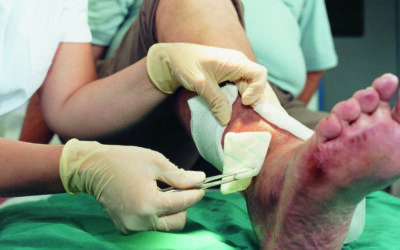 Fristverlängerung zur Wundversorgung rückwirkend in Kraft getreten